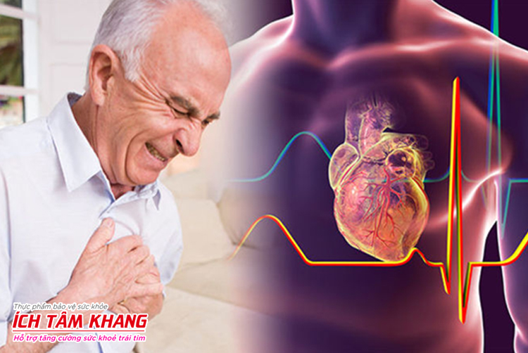 Nhồi máu cơ tim không những nguy hiểm mà còn để lại nhiều hệ lụy khôn lường